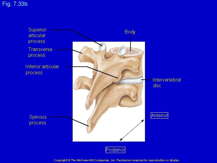 Fig. 7. 33 b Superior articular process Body Transverse process Inferior articular process Intervertebral