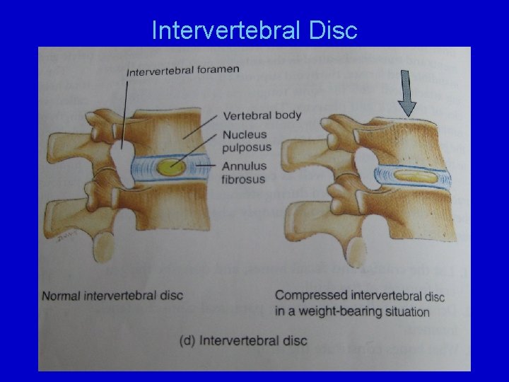 Intervertebral Disc 