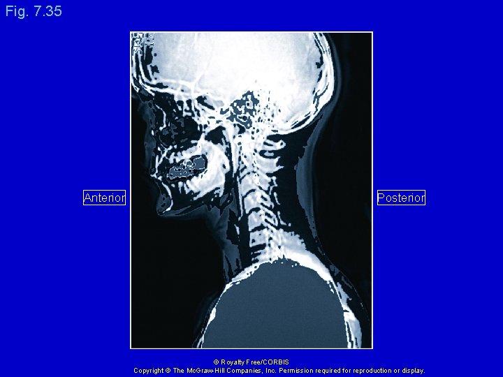 Fig. 7. 35 Anterior Posterior © Royalty Free/CORBIS Copyright © The Mc. Graw-Hill Companies,