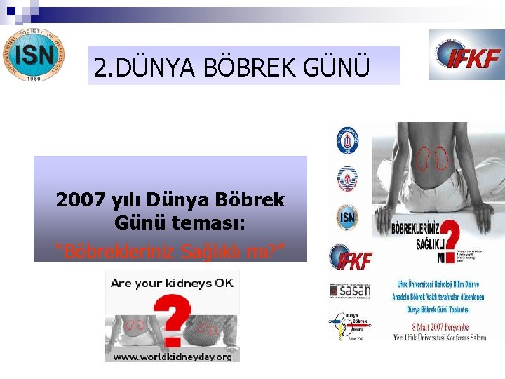 2. DÜNYA BÖBREK GÜNÜ 2007 yılı Dünya Böbrek Günü teması: “Böbrekleriniz Sağlıklı mı? ”