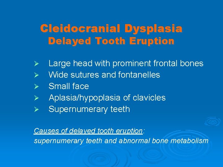 Cleidocranial Dysplasia Delayed Tooth Eruption Ø Ø Ø Large head with prominent frontal bones