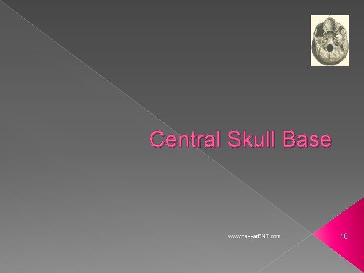 Central Skull Base www. nayyar. ENT. com 10 