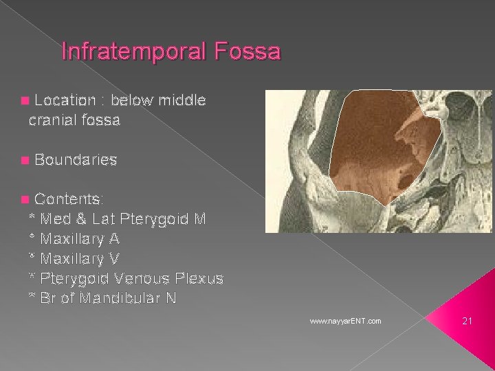 Infratemporal Fossa Location : below middle cranial fossa n n Boundaries Contents: * Med