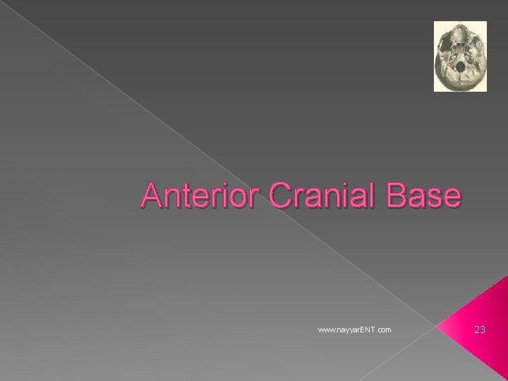 Anterior Cranial Base www. nayyar. ENT. com 23 