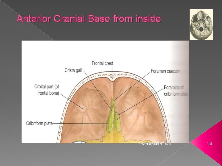 Anterior Cranial Base from inside www. nayyar. ENT. com 24 