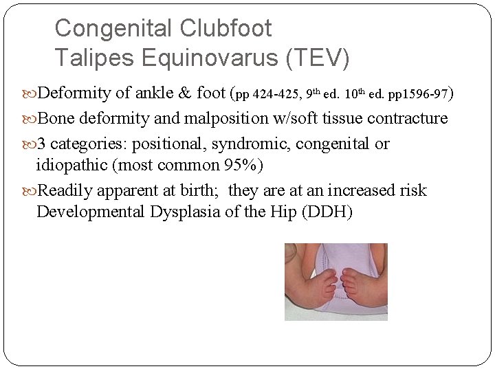 Congenital Clubfoot Talipes Equinovarus (TEV) Deformity of ankle & foot (pp 424 -425, 9