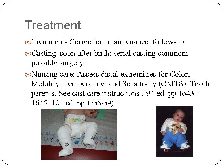 Treatment- Correction, maintenance, follow-up Casting soon after birth; serial casting common; possible surgery Nursing