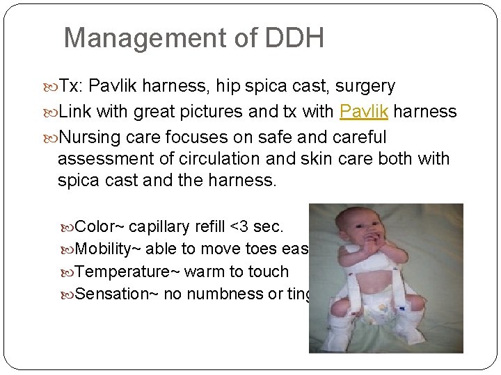 Management of DDH Tx: Pavlik harness, hip spica cast, surgery Link with great pictures