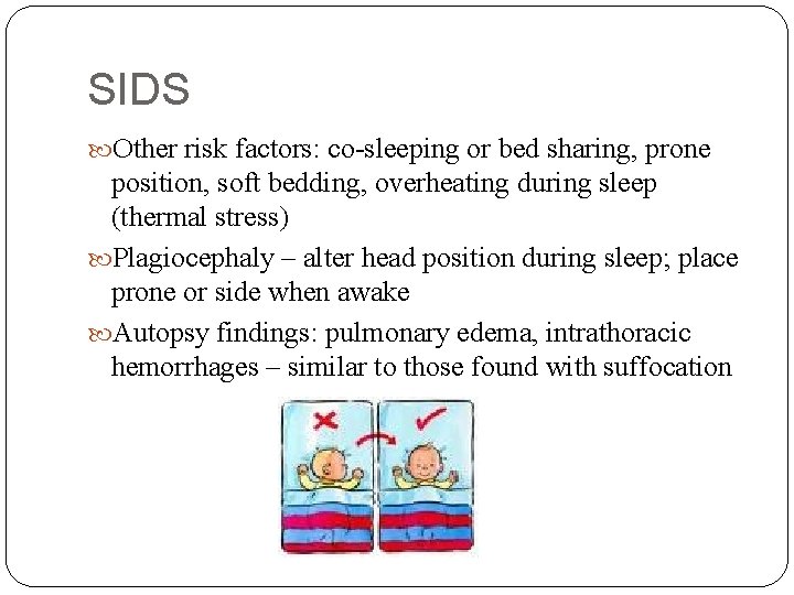 SIDS Other risk factors: co-sleeping or bed sharing, prone position, soft bedding, overheating during