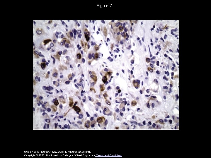 Figure 7. CHEST 2010 1381247 -1252 DOI: (10. 1378/chest. 09 -2439) Copyright © 2010