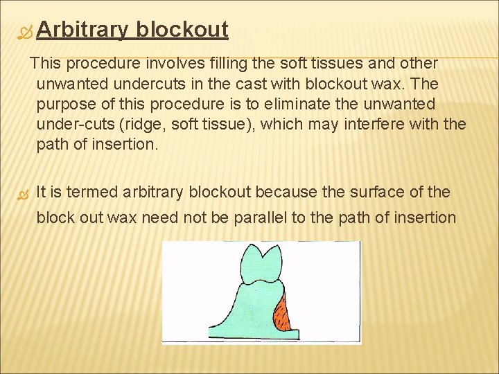  Arbitrary blockout This procedure involves filling the soft tissues and other unwanted undercuts