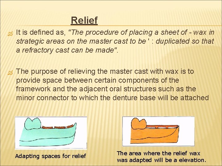 Relief It is defined as, "The procedure of placing a sheet of - wax