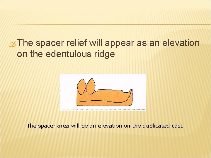  The spacer relief will appear as an elevation on the edentulous ridge The