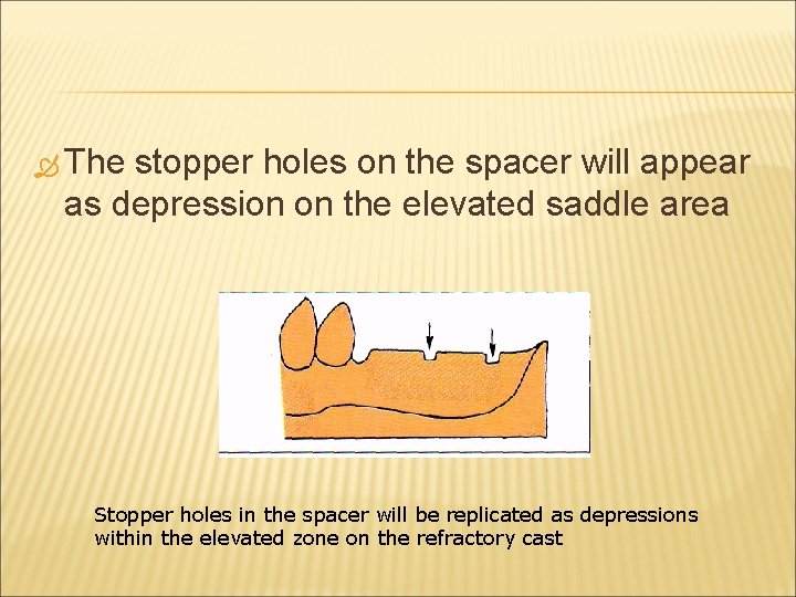  The stopper holes on the spacer will appear as depression on the elevated