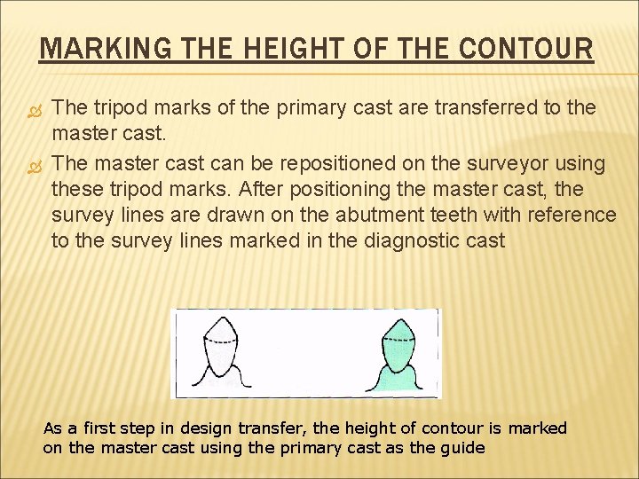 MARKING THE HEIGHT OF THE CONTOUR The tripod marks of the primary cast are