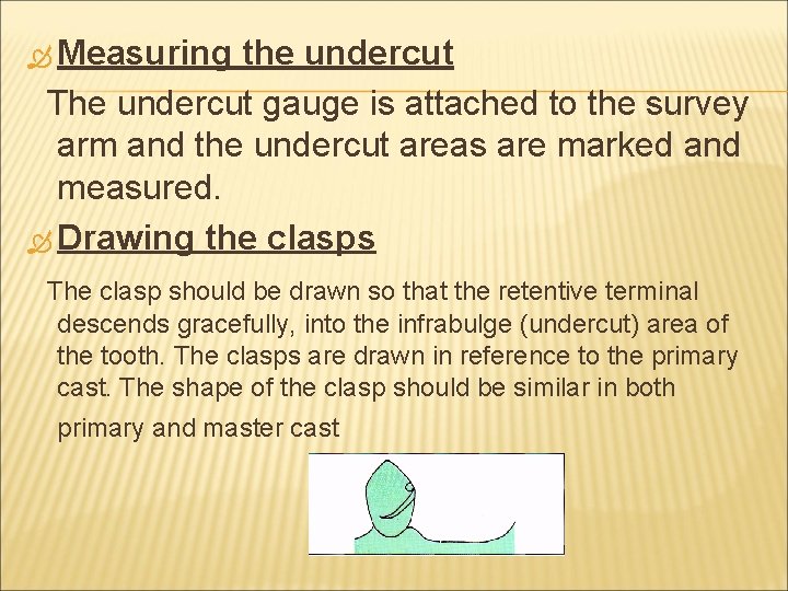  Measuring the undercut The undercut gauge is attached to the survey arm and