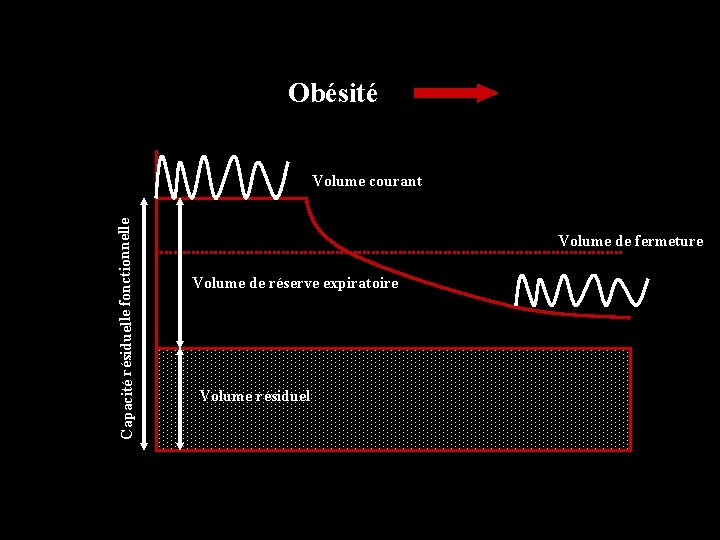 Obésité Capacité résiduelle fonctionnelle Volume courant Volume de fermeture Volume de réserve expiratoire Volume