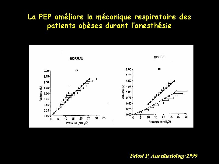 La PEP améliore la mécanique respiratoire des patients obèses durant l’anesthésie Pelosi P, Anesthesiology