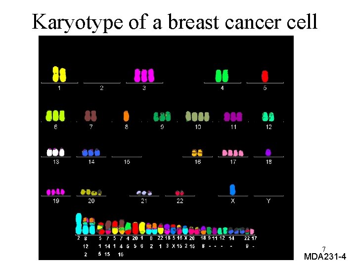 Karyotype of a breast cancer cell 7 MDA 231 -4 