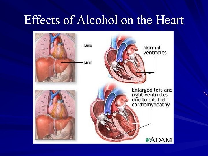 Effects of Alcohol on the Heart 