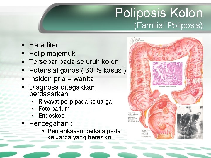 Poliposis Kolon (Familial Poliposis) § § § Herediter Polip majemuk Tersebar pada seluruh kolon