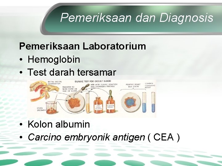 Pemeriksaan dan Diagnosis Pemeriksaan Laboratorium • Hemoglobin • Test darah tersamar • Kolon albumin