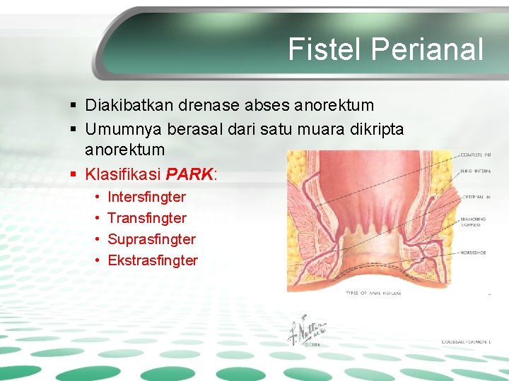 Fistel Perianal § Diakibatkan drenase abses anorektum § Umumnya berasal dari satu muara dikripta