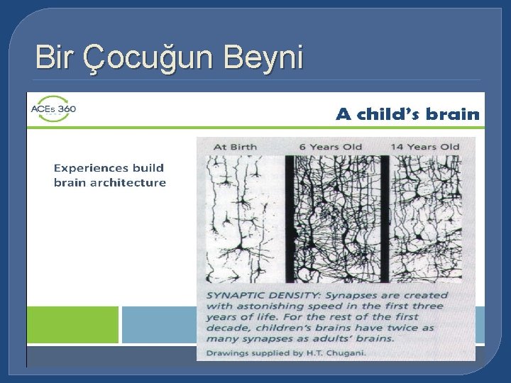 Bir Çocuğun Beyni 