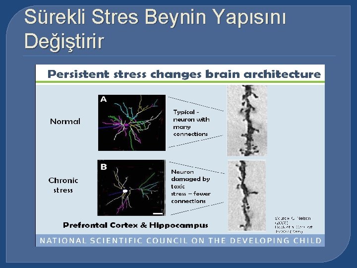 Sürekli Stres Beynin Yapısını Değiştirir 