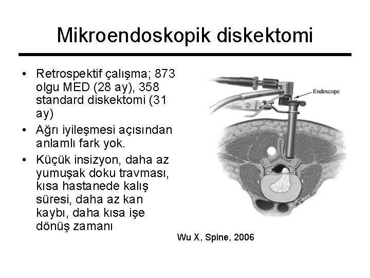Mikroendoskopik diskektomi • Retrospektif çalışma; 873 olgu MED (28 ay), 358 standard diskektomi (31