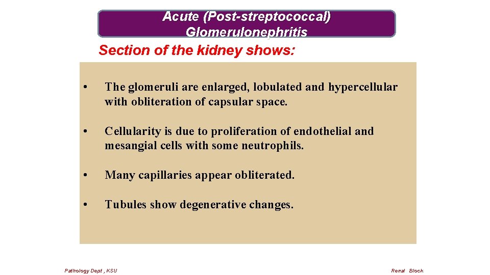 Acute (Post-streptococcal) Glomerulonephritis Section of the kidney shows: • The glomeruli are enlarged, lobulated
