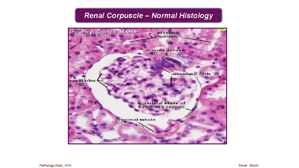 Renal Corpuscle – Normal Histology Pathology Dept , KSU Renal Block 
