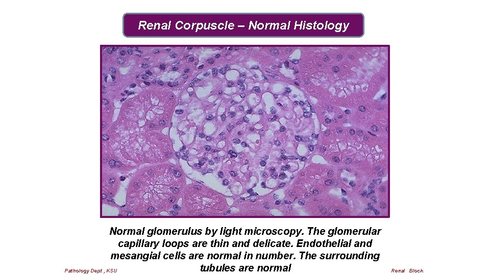 Renal Corpuscle – Normal Histology Normal glomerulus by light microscopy. The glomerular capillary loops