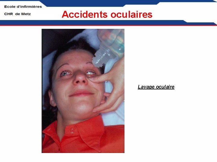 Accidents Oculaires Brlures Chimiques Lavage Immdiat Robinet Grande accidents-oculaires-brlures-chimiques-lavage-immdiat-robinet-grande
