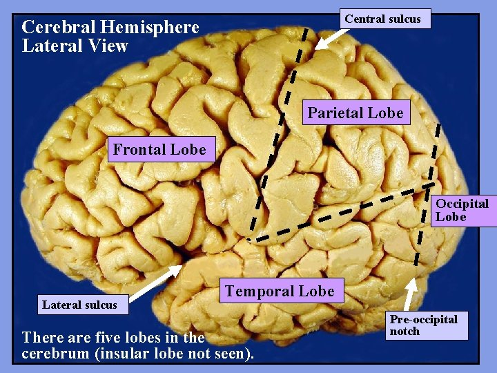 Central sulcus Cerebral Hemisphere Lateral View Parietal Lobe Frontal Lobe Occipital Lobe Lateral sulcus