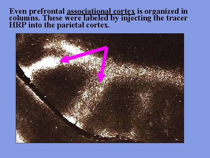 Even prefrontal associational cortex is organized in columns. These were labeled by injecting the