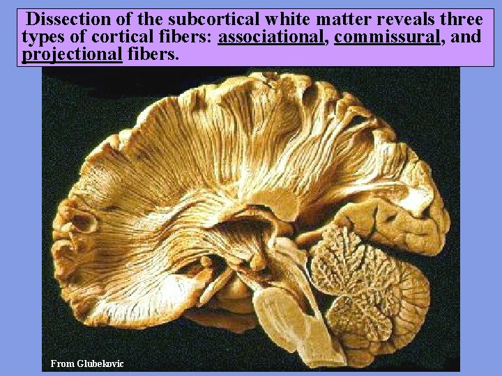 Dissection of the subcortical white matter reveals three types of cortical fibers: associational, commissural,
