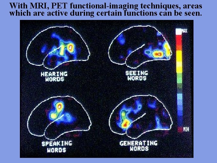 With MRI, PET functional-imaging techniques, areas which are active during certain functions can be