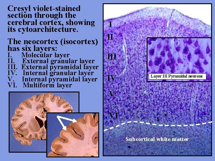 Cresyl violet-stained section through the cerebral cortex, showing its cytoarchitecture. The neocortex (isocortex) has