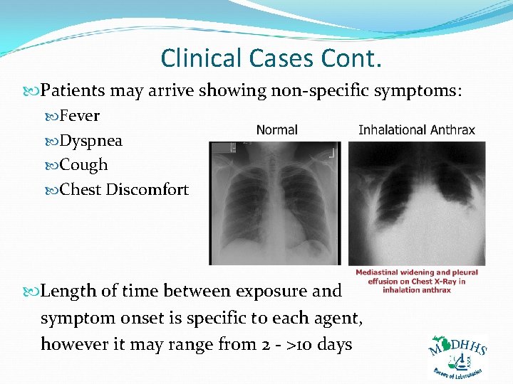 Clinical Cases Cont. Patients may arrive showing non-specific symptoms: Fever Dyspnea Cough Chest Discomfort