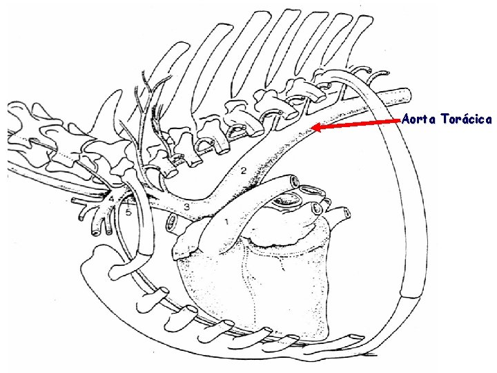 Aorta Torácica 