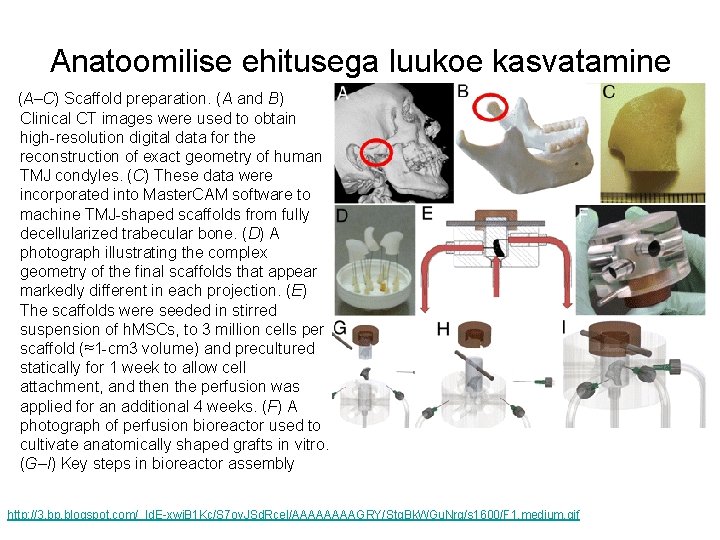 Anatoomilise ehitusega luukoe kasvatamine (A–C) Scaffold preparation. (A and B) Clinical CT images were