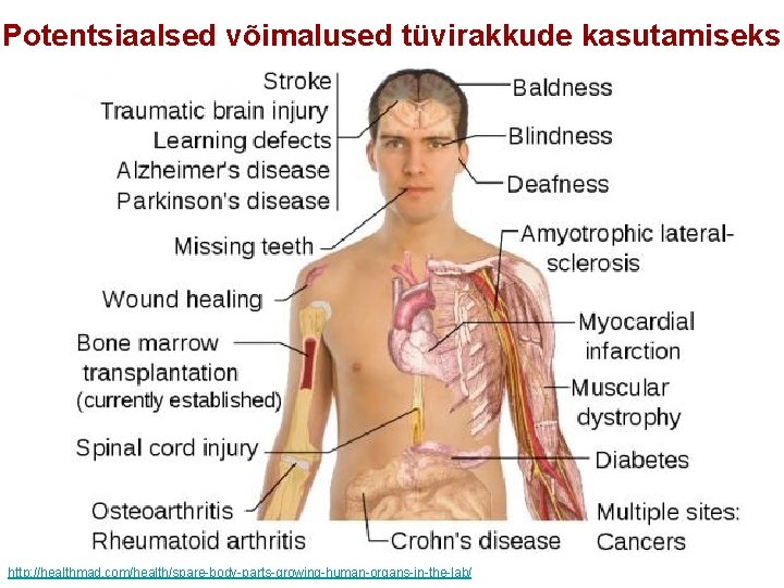 Potentsiaalsed võimalused tüvirakkude kasutamiseks http: //healthmad. com/health/spare-body-parts-growing-human-organs-in-the-lab/ 