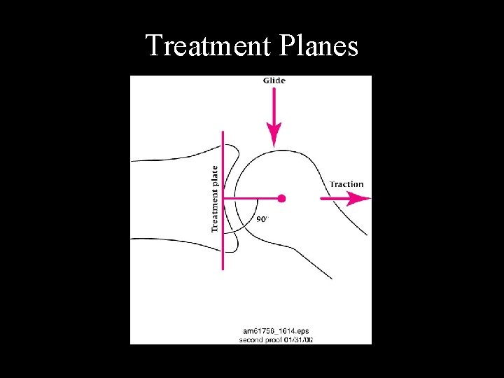 Treatment Planes Treatment Planes