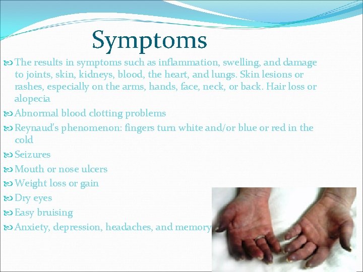 Symptoms The results in symptoms such as inflammation, swelling, and damage to joints, skin,