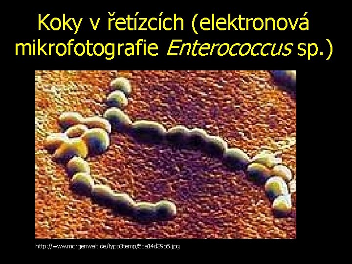 Koky v řetízcích (elektronová mikrofotografie Enterococcus sp. ) http: //www. morgenwelt. de/typo 3 temp/5