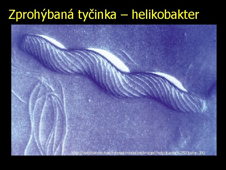 Zprohýbaná tyčinka – helikobakter http: //vietsciences. free. fr/nobel/medecine/images/helicobacter%2520 pylori. JPG 