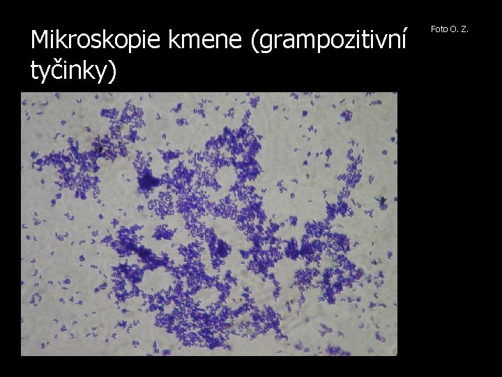 Mikroskopie kmene (grampozitivní tyčinky) Foto O. Z. 