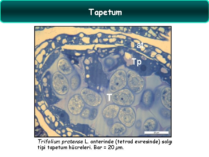 Tapetum Trifolium pratense L. anterinde (tetrad evresinde) salgı tipi tapetum hücreleri. Bar = 20