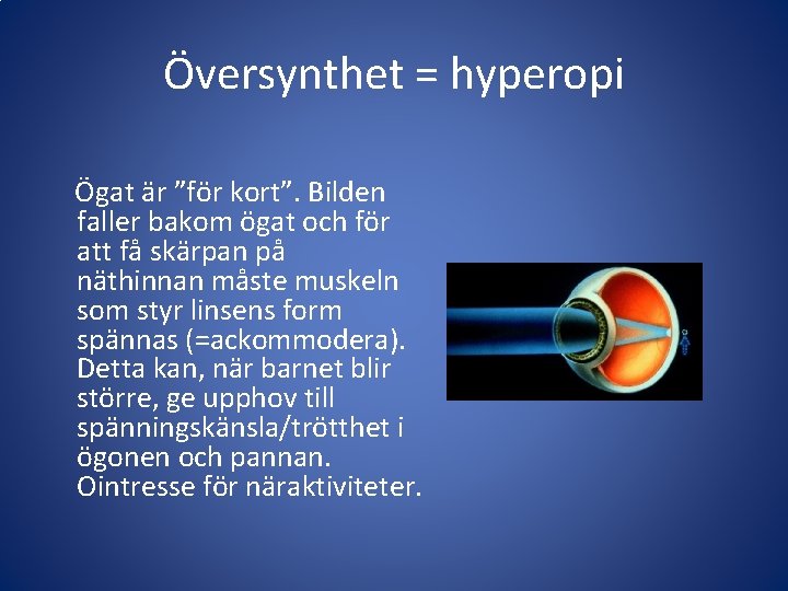 Översynthet = hyperopi Ögat är ”för kort”. Bilden faller bakom ögat och för att